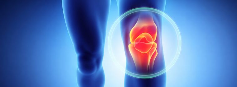 Ízületi porc elvékonyodása